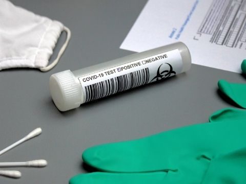 test antigénique